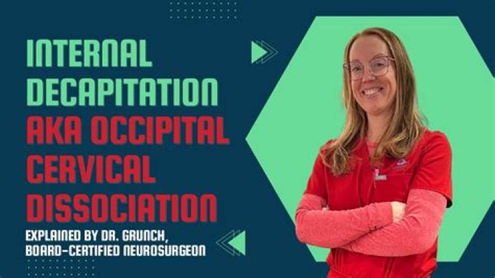 Internally Decapitated: Understanding the Rare and Complex Medical Condition