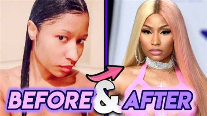 Nicki Minaj Before Any Surgery: A Journey Through Her Early Life and Transformation